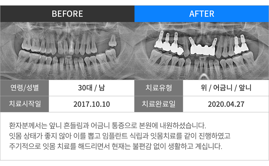 진료일지