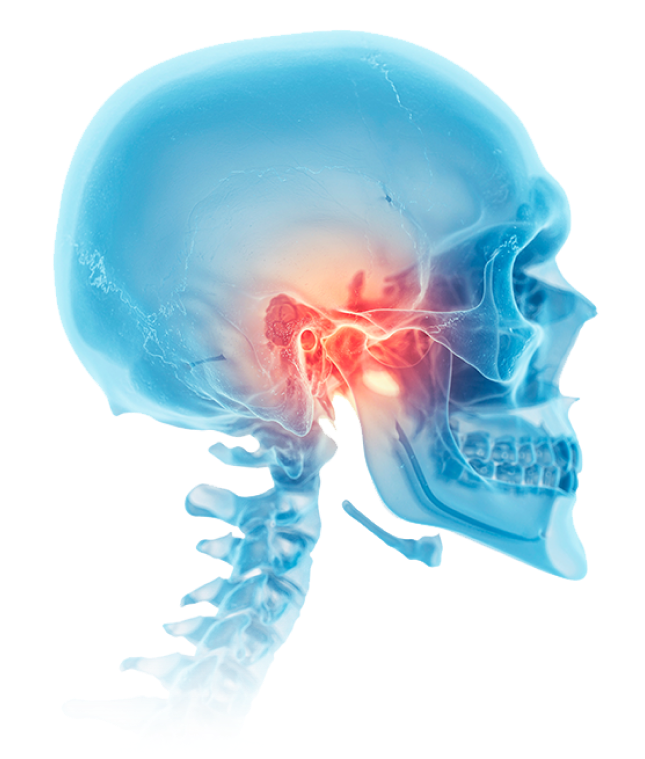 턱관절 x-ray